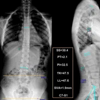 کمردرد، درد مفاصل، کف پای صاف