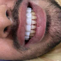 خدمات دندانپزشکی با مناسبترین قیمت