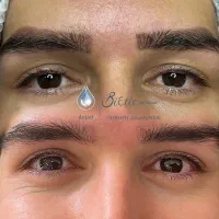 تعداد محدود،برای پاک کردن تتوفقط تماس بگیرید