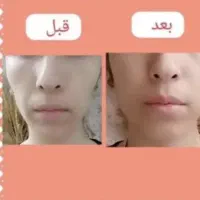 پودر جوانه گندم چاقی صورت صد درصد تضمینی|خوردنی و آشامیدنی|مشهد, رده|دیوار