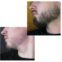 با این سرم. دیگه کوسه نباش