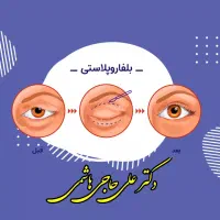 زیبائی پلک بالا و پائین