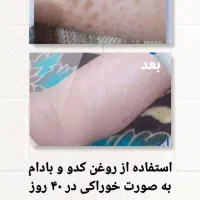 روغن های درمانی صددرصد خالص|حراج|کرج, دانشگاه هنر تهران (پردیس کرج)|دیوار