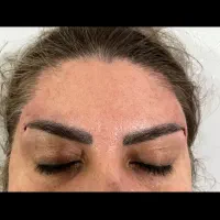 ژل و بوتاکس|خدمات آرایشگری و زیبایی|شیراز, زرهی|دیوار