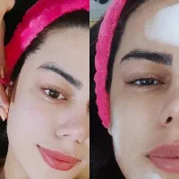 فشیال کاشت ناخن