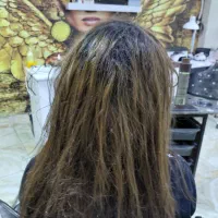 خدمات احیاوصافی و موخوره گیری