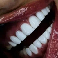 خدمات درمانی و زیبایی دندان|خدمات آرایشگری و زیبایی|کرمانشاه, |دیوار