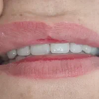 دندانسازی بانو دنت.با چک