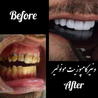 ارتودنسی ارزانتر از تعرفه نظام پزشکی،ایمپلنت فوری|خدمات آرایشگری و زیبایی|تهران, آذربایجان|دیوار