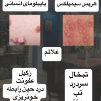 بیماری های ویروسی زگیل و تبخال|خدمات آرایشگری و زیبایی|خمینی‌شهر, |دیوار