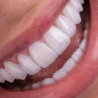 ساکشن غبغب شکم پهلو|خدمات آرایشگری و زیبایی|شیراز, عفیف‌آباد|دیوار