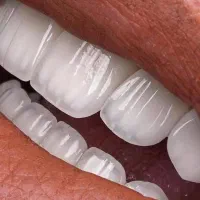 ۵۰۰میلیون سرمایه جهت شرکت در مطب دندانپزشکی