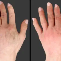 جشنواره ژل و بوتاکس  فروردین ۱۴۰۵