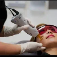 آف ویژه لیزرموهای زائدبا کندلای شاتی آمریکایی 2025