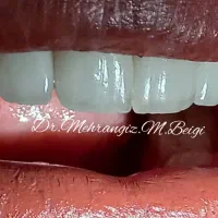 دندانپزشکی زیبایی و لمینت|خدمات آرایشگری و زیبایی|تهران, سلیمانی|دیوار