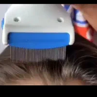 درمان رشک و شپش