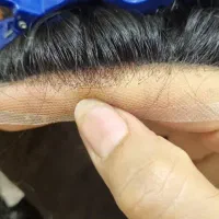 پروتز مو بافت مو ترمیم مو سجادی ارزانتر از همه جا|خدمات آرایشگری و زیبایی|تهران, جوادیه تهرانپارس|دیوار