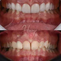 ایمپلنت و لمینیت اقساطی ( فولادشهر )|خدمات آرایشگری و زیبایی|فولادشهر, B2|دیوار