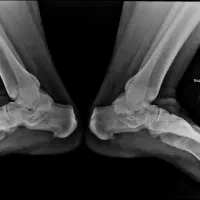 رادیولوژی در منزل