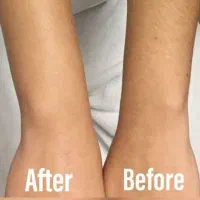 لیزر خانگی موهای زائد صورت و بدن/تخفیف بلک فرایدی|آرایشی، بهداشتی، درمانی|قم, زنبیل آباد|دیوار