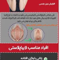 درمان زگیل آقا وخانم هالابیا پلاسی توسط پزشک متخصص