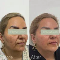 ژل بوتاکس لیزر لاغری مشاوره رایگان مطب دکتر فرخی|خدمات آرایشگری و زیبایی|اسلامآباد غرب, |دیوار