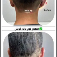 جراحی زیبایی لیپو ابدو بلفارو لیفت پروتز بینی