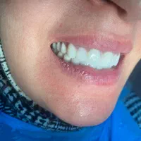 خدمات دندانپزشکی*هنر دنت*|پزشکی|سهند, |دیوار
