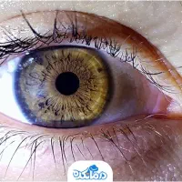 چشم پزشک محلی