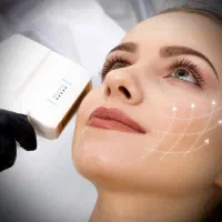 هایفو اولترافورمر برای لیفت صورت