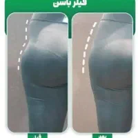 بوتاکس فیلر تخصصی و فیلر بادی و پی ارپی|خدمات آرایشگری و زیبایی|کرمانشاه, |دیوار