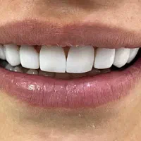 جشنواره پاییزه کامپوزیت فقط 1/500|خدمات آرایشگری و زیبایی|شیراز, تندگویان|دیوار
