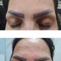 تزریق ژل+بوتاکس|خدمات آرایشگری و زیبایی|اهواز, پردیس دو|دیوار