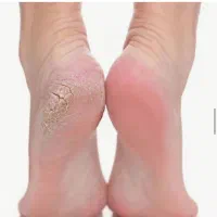 اسپاو پدیکور روشن سازی دست ‌و پا