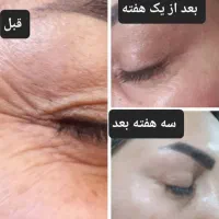 جوانسازی|آرایشی، بهداشتی، درمانی|شیراز, ابیوردی|دیوار