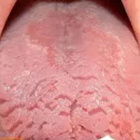 آموزش زبان انگلیسی