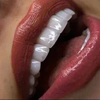 جشنواره کامپوزیت دندان فقط واحدی یک و نیم