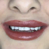 دندان پزشکی لبخند سفید|خدمات آرایشگری و زیبایی|ماهنشان, |دیوار