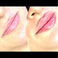 زیبایی نیلگون تخفیف ویژه به مناسب یک ماه