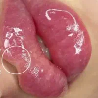 ژل لب/بوتاکس/فیلر|خدمات آرایشگری و زیبایی|کرج, گوهردشت|دیوار