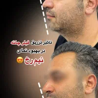 جشنواره زیبایی کلینیک آس|خدمات آرایشگری و زیبایی|تهران, تهرانسر مرکزی|دیوار