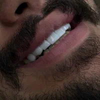 کامپوزیت مونوکروم با قیمت استثنایی