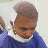 کاشت مو بدون جراحی و درد (کاملا تضمینی)