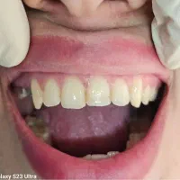 دندانپزشکی|خدمات آرایشگری و زیبایی|ارومیه, |دیوار