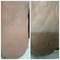 کاشت ناخن پدیکورپا لمینت ژلیش آموزش مجازی وحضوری|خدمات آرایشگری و زیبایی|مشهد, گلبرگ|دیوار