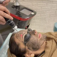 جشنواره ی کلینیک زیبایی بمناسبت روز زن|خدمات آرایشگری و زیبایی|تهران, تهرانپارس غربی|دیوار