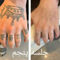 لیزر پاک کردن تتو بشکل مدرن|خدمات آرایشگری و زیبایی|اهواز, فرهنگ شهر|دیوار