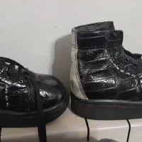 کفش طبی دست ساز ، درمان پا پرانتزی کودک