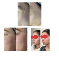 خدمات پوست و مو|خدمات آرایشگری و زیبایی|مراغه, |دیوار