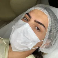 شیدینگ لب میکروبلیدینگ